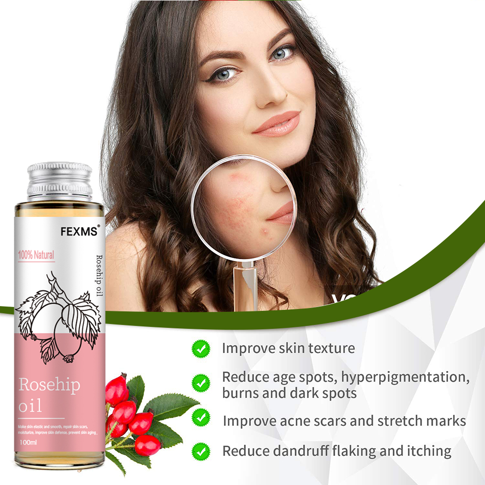 Rosehip Seed Oil, 100% Pure Or - Cold Pressed Rose Hip ulasan dan harga