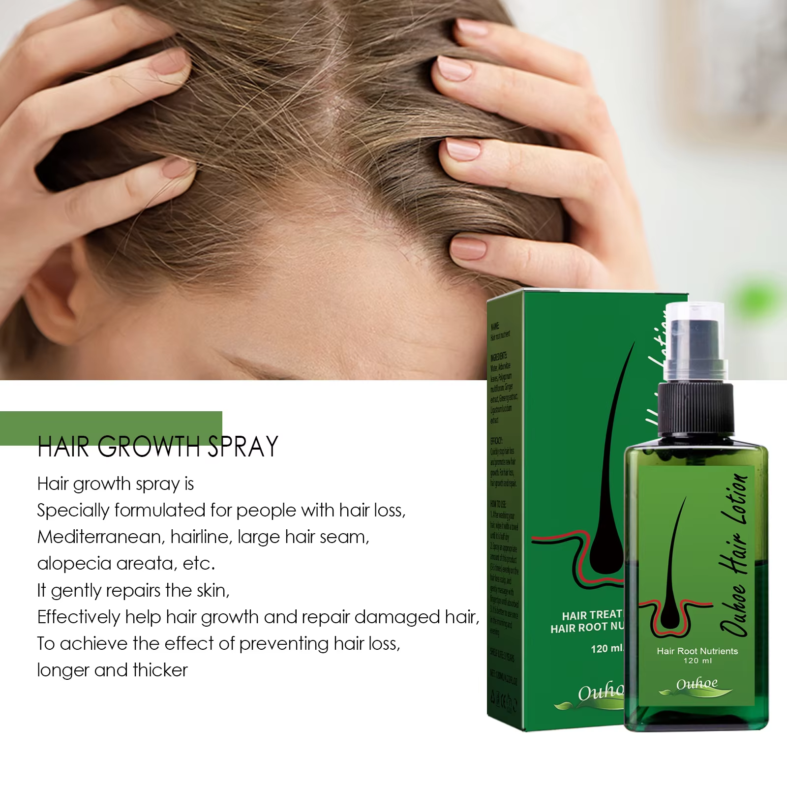 Hair Growth Spray Anti Hair Lo - Growth Factor Serum ulasan dan harga